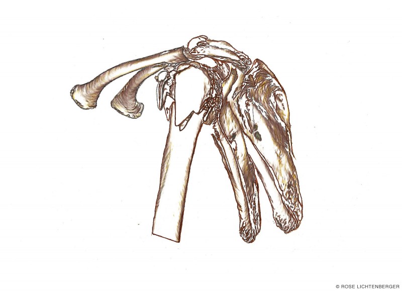 Abbildung: Game of Broken Bones